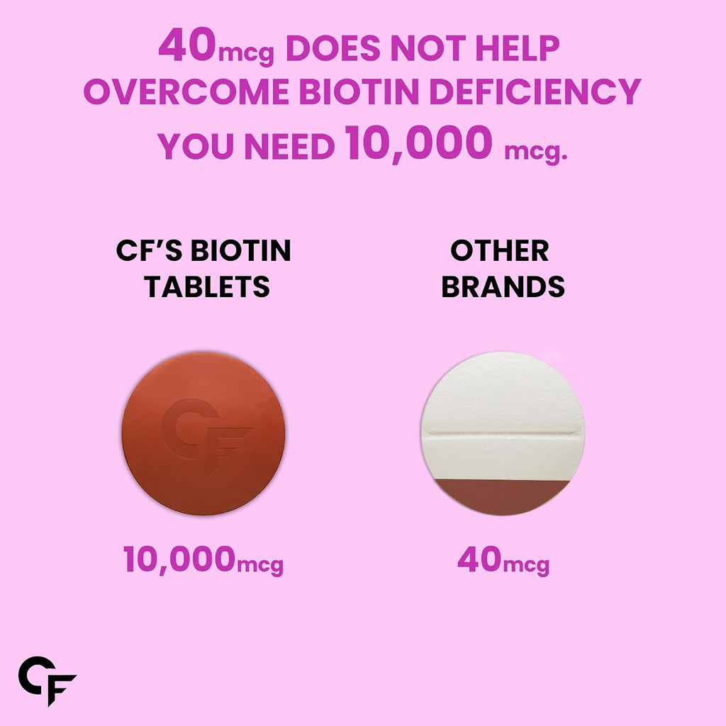 Carbamide Forte Biotin Tablets for Hair Growth | Biotin Supplement 10000 mcg | Hair Supplements for Women & Men | 120 Hair Growth Tablets - 4 Months Supply