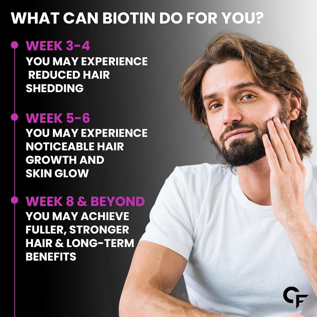 Carbamide Forte Biotin Tablets for Hair Growth | Biotin Supplement 10000 mcg | Hair Supplements for Women & Men | 120 Hair Growth Tablets - 4 Months Supply
